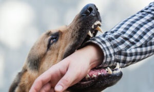 Why Choose Kenny Ramirez Law Firm to Help Me With My Dog Bite Claim in California?